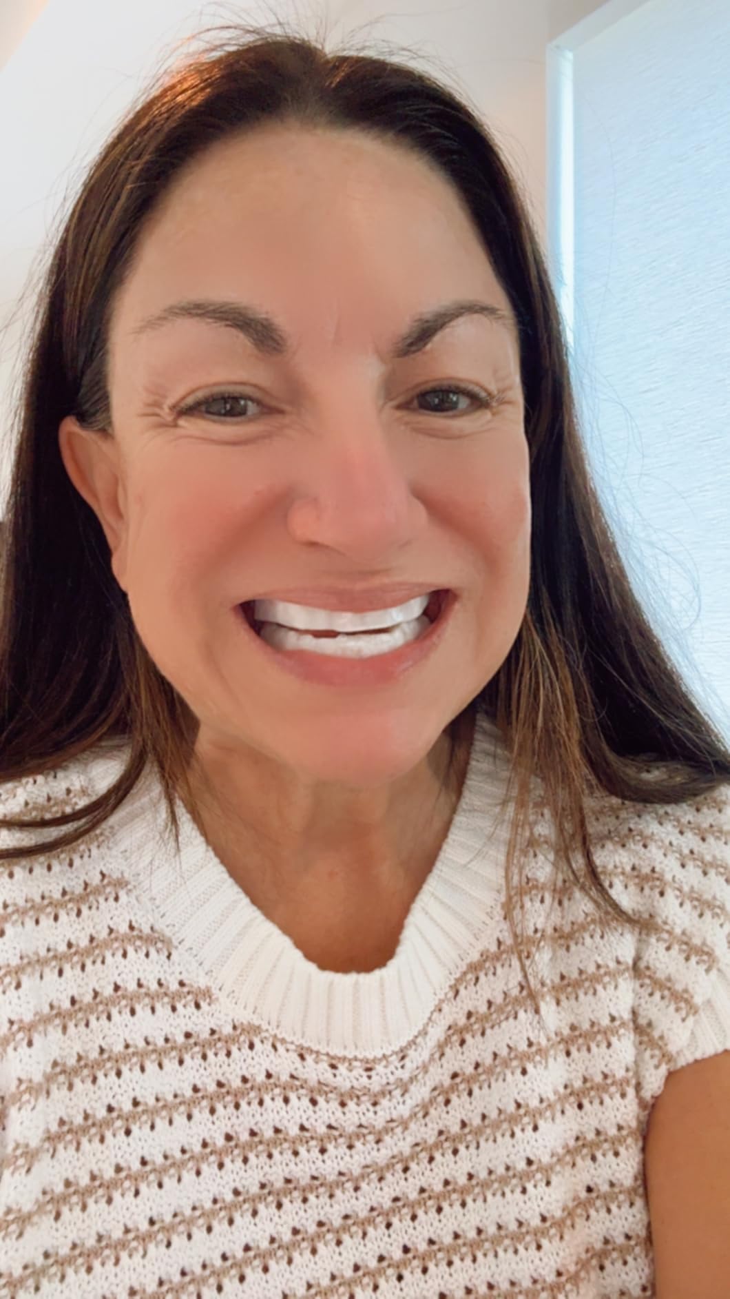 Opalescence Go 15% Mint - Prefilled Teeth Whitening Trays - 5194 customer photo 2