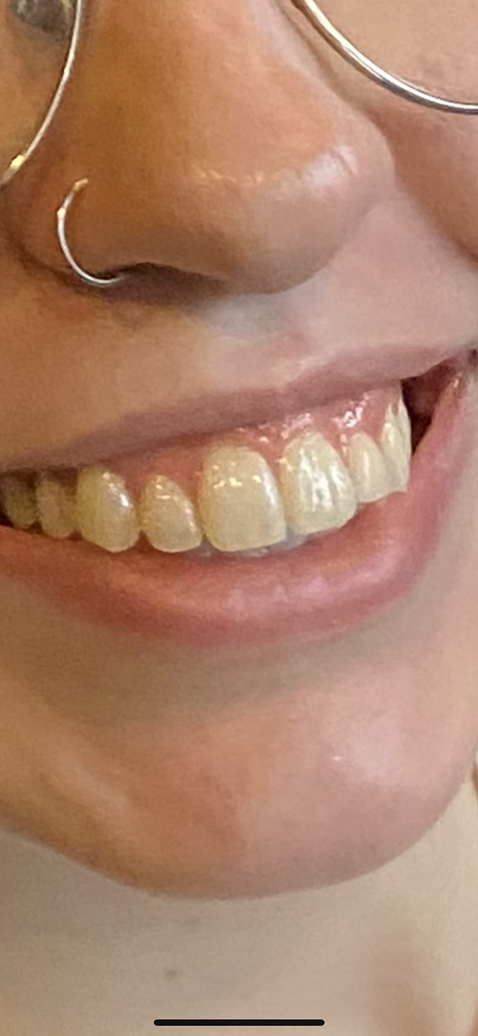 Crest Teeth Whitening Strips, Crest 3D Whitestrips 2 Week Smile Transformation, Enamel Safe Teeth Whitening Kit, 16 Treatments (32 Strips), Whiter Teeth in 2 Weeks, 11 Levels Whiter customer photo 1