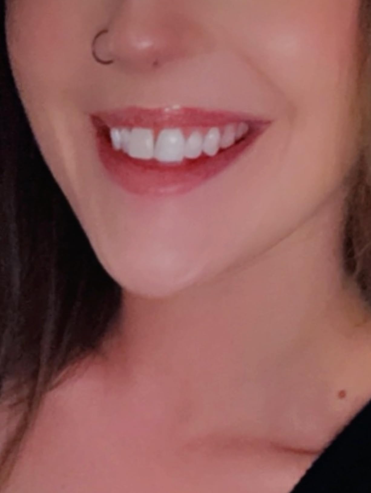 SmileDirectClub Teeth Whitening Kit with LED Light - 4 Pack Gel Pens - Professional Strength Hydrogen Peroxide customer photo 1