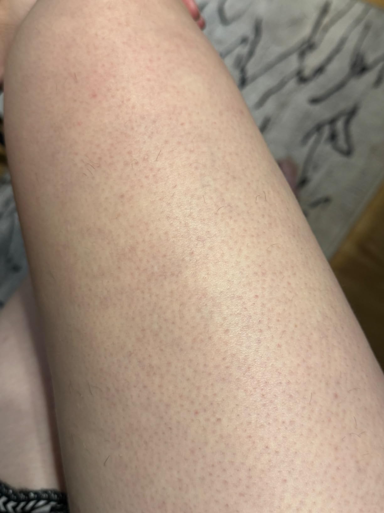 Braun IPL, Silk·Expert Pro 5, IPL Hair Removal for Women and Men, Permanent Laser Hair Reduction At-Home, 2 Heads, Pouch, Venus Razor, IPL5157 customer photo 1