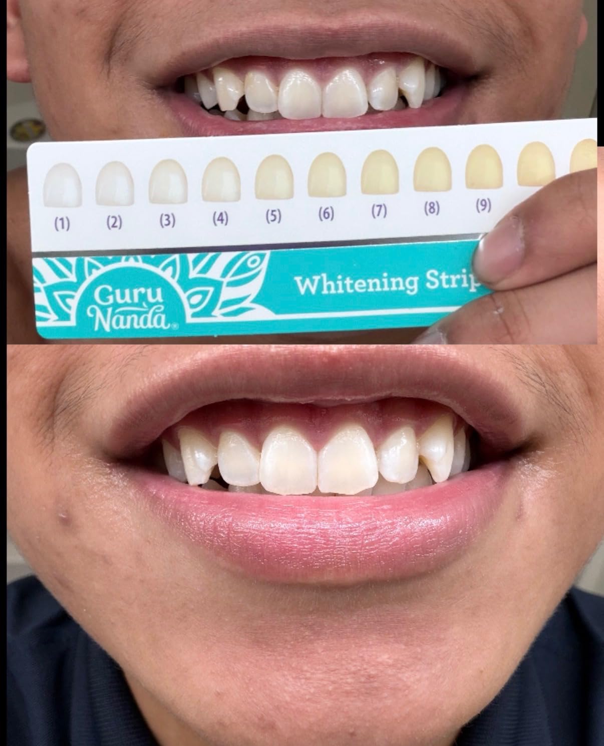 GuruNanda Teeth Whitening Strips - 4X Whiter Teeth, 7-Day Whitening Kit customer photo 2